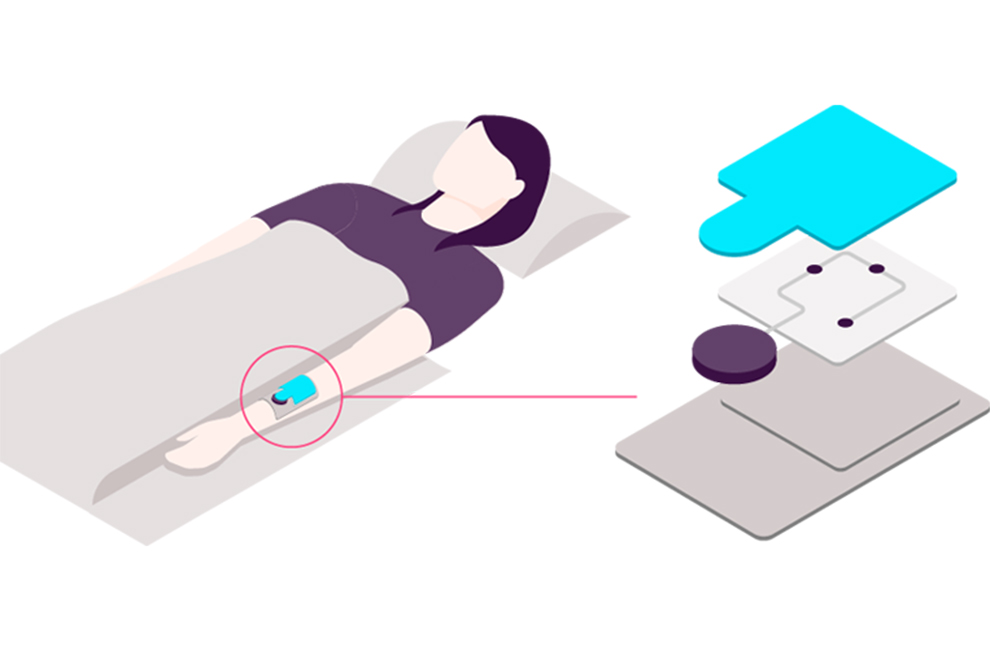 En människa som ligger i en säng med ett digitalt förband på armen. Illustration. 